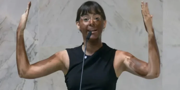 Deputada Fabiana Bolsonaro faz ‘blackface’ em protesto transfóbico